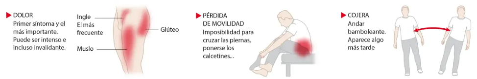 dolor articular