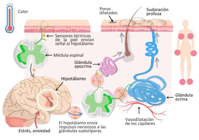 hiperhidrosis