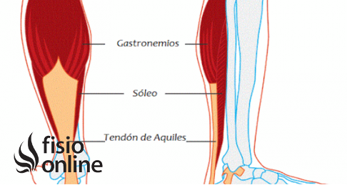 talon de aquiles